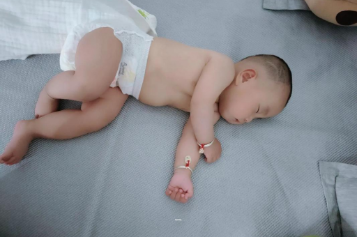 山西宝宝脸上有白色斑块